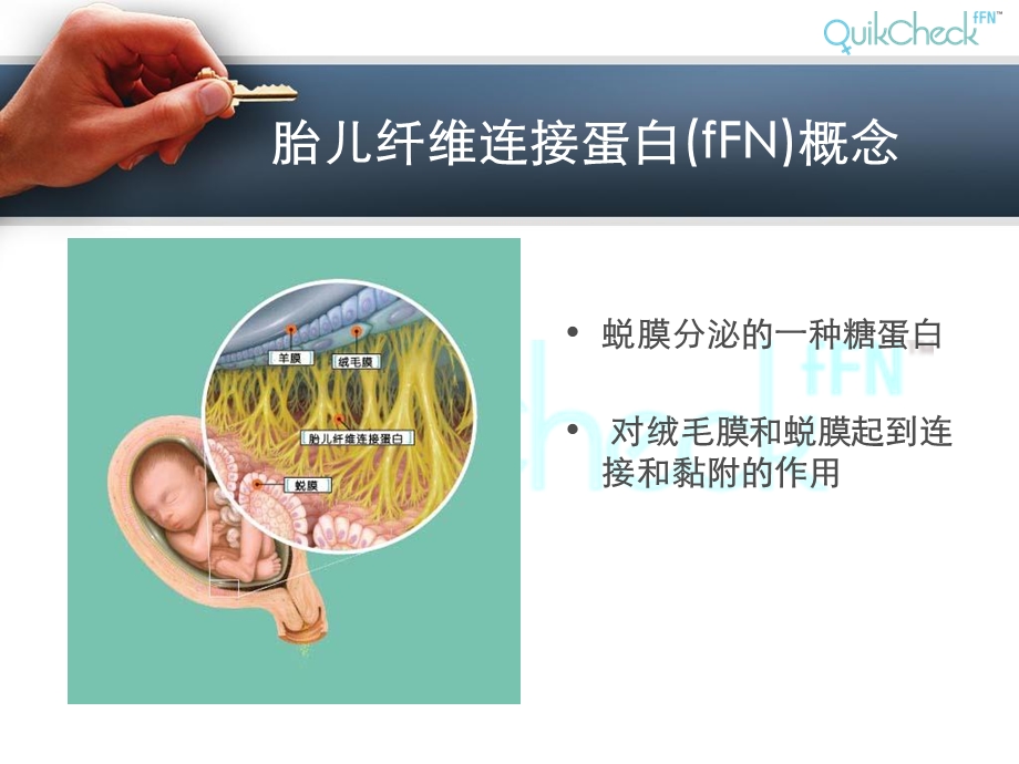 fFN临床应用文档资料.ppt_第1页