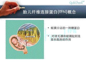 fFN临床应用文档资料.ppt