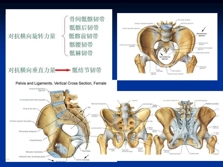 合并骶骨骨折的骨盆后环损伤的治疗省骨科年会精选文档.ppt_第3页