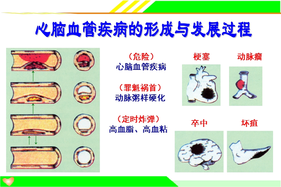 最新：电位治疗器与心脑血管疾病ppt课件文档资料.ppt_第3页