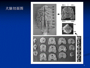 内科神经系统文档资料.ppt