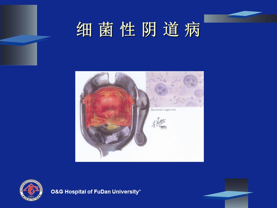 盆腔感性疾病文档资料.ppt_第3页