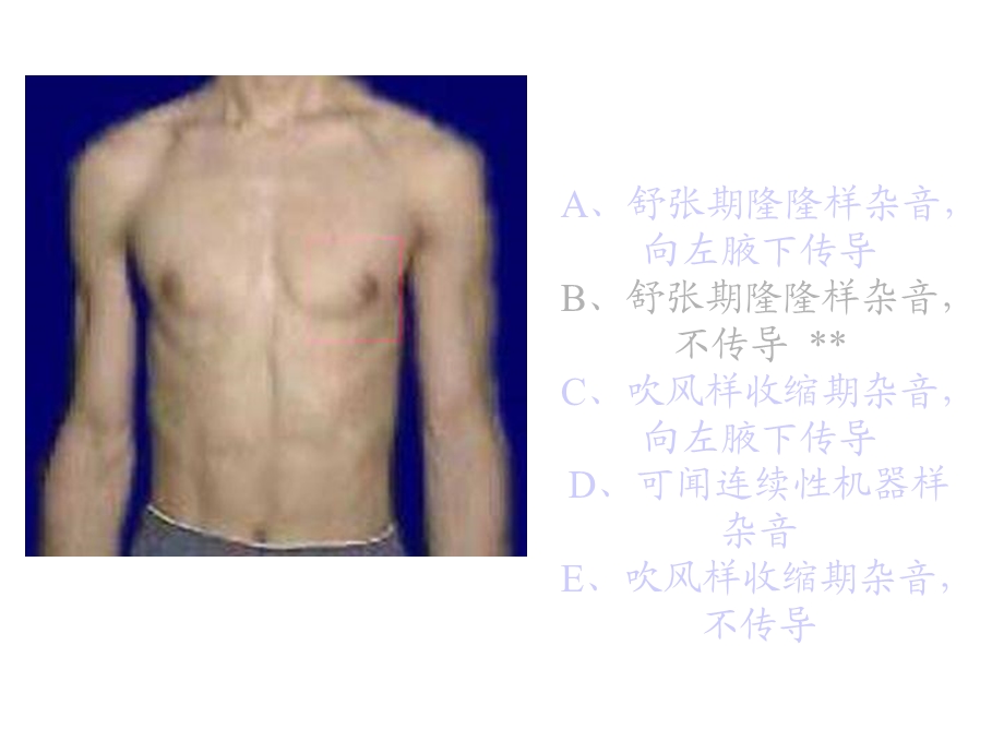 最新：执业医师操作考试心脏听诊文档资料.ppt_第1页