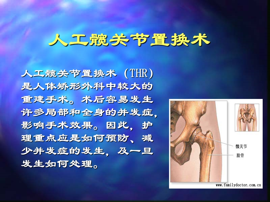 最新人工关节置换术护理PPT文档.ppt_第1页