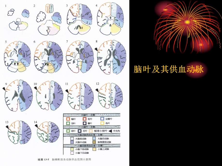 最新梗塞、出血1PPT文档.ppt_第2页