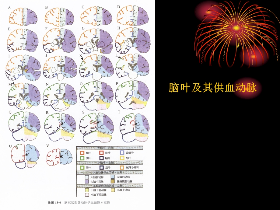 最新梗塞、出血1PPT文档.ppt_第3页