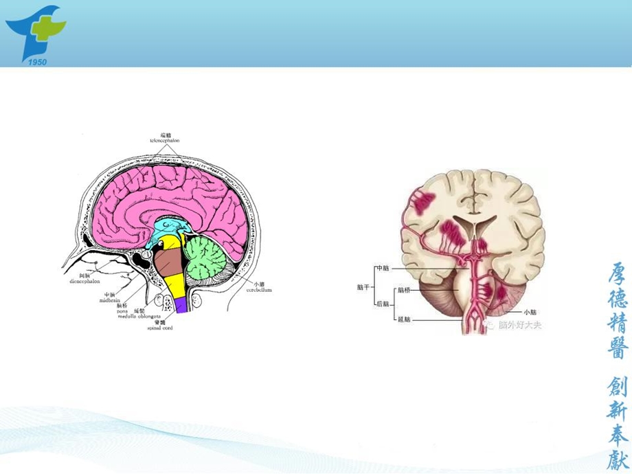 最新小脑出血诊疗规范PPT文档.ppt_第3页