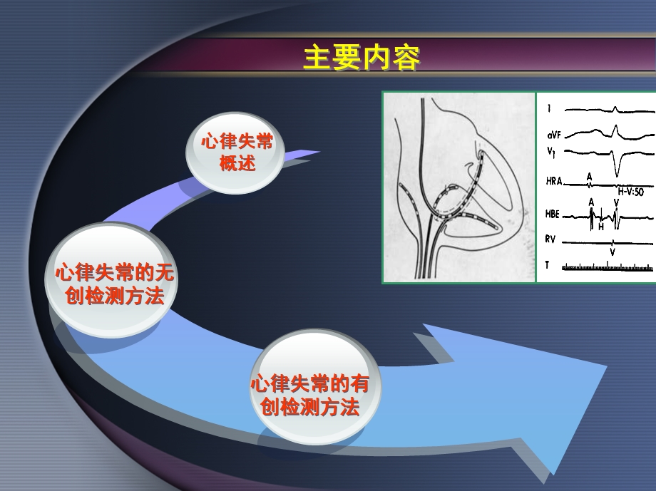 心律失常的有创和无创检测方法ppt课件PPT文档.ppt_第1页