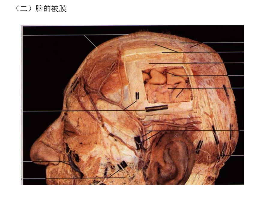 最新：第四节脑和脊髓的被膜血管及脑脊液循环文档资料.ppt_第2页