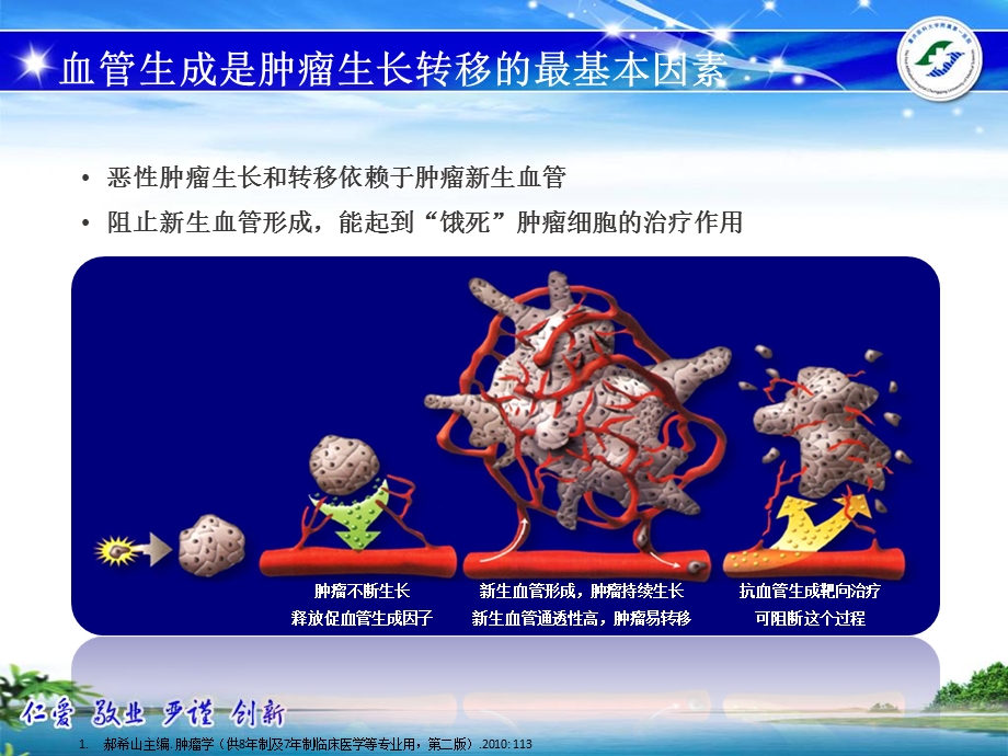 乳腺癌抗血管生成治疗PPT文档资料.pptx_第3页