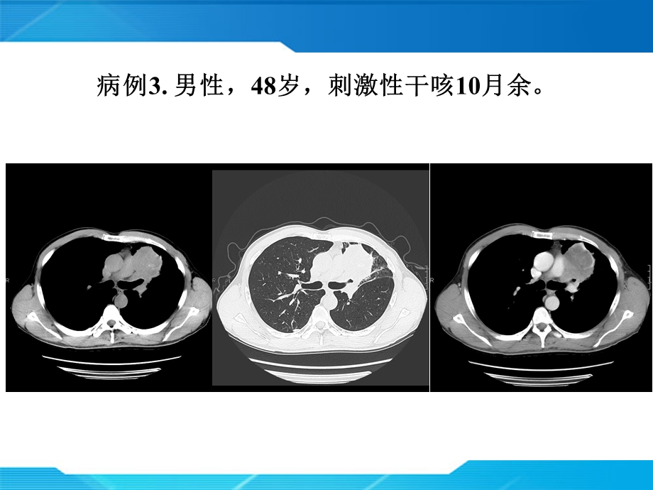 最新：研究生毕业考影像学读片外科考题文档资料.ppt_第3页