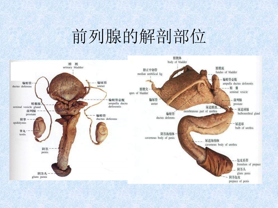 前列腺增生症文档资料.ppt_第2页