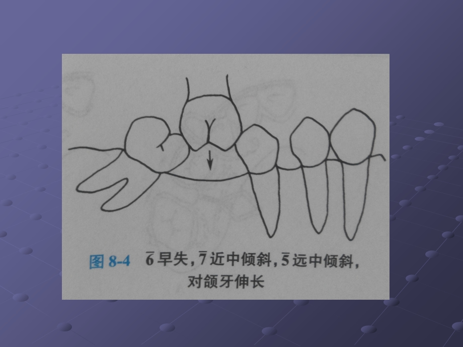 最新：青少年口腔正畸矫治二ppt课件文档资料.ppt_第2页