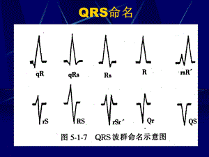 最新心电一院心电心肌缺血心梗心律失常PPT文档.ppt