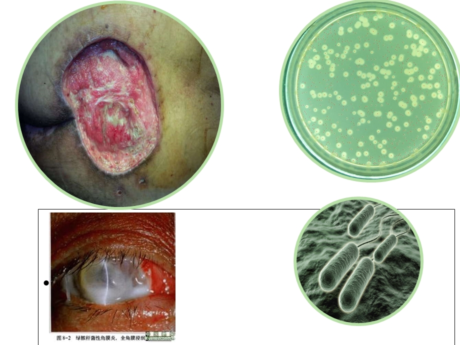最新铜绿假单胞感染课件PPT文档.ppt_第2页