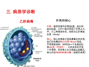 最新深圳大学理科选修人类传染病灾难与对策课件第八讲乙肝2PPT文档.pptx