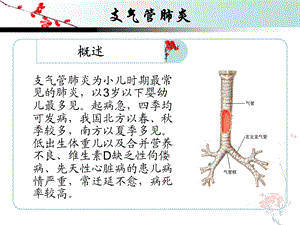 最新小儿支气管肺炎的护理查房1PPT文档.ppt