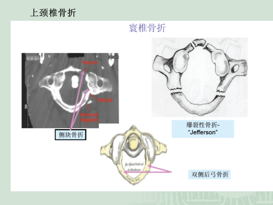 最新：颈椎常见疾病的诊断与治疗文档资料.ppt_第3页