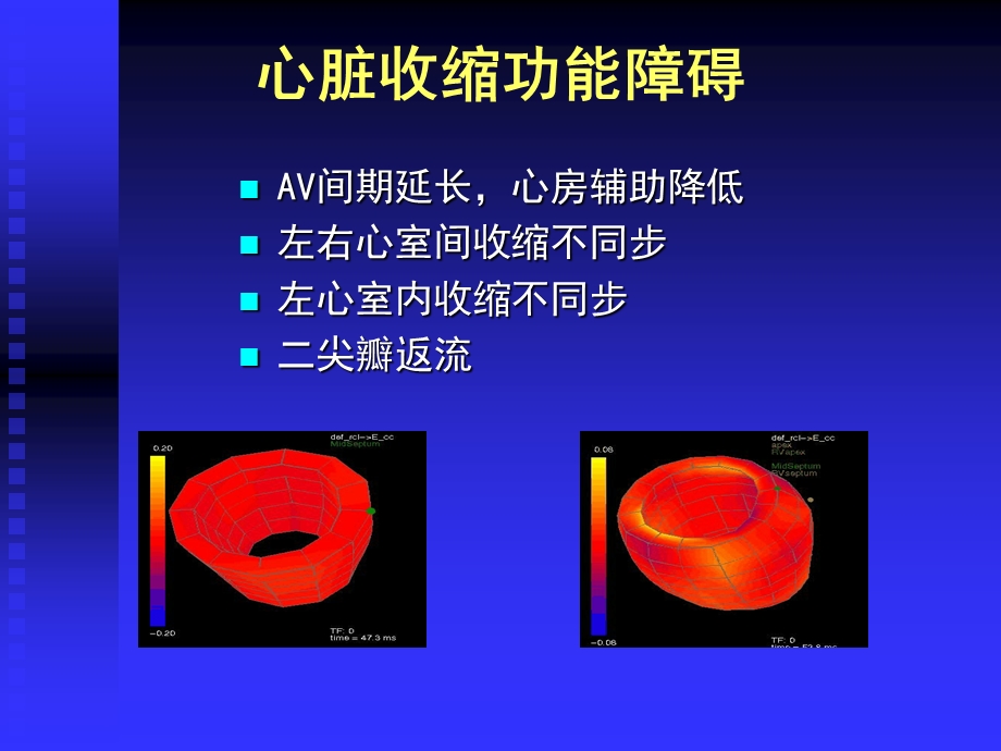 最新：【医药健康】心力衰竭的心脏再同步治疗ppt文档资料.ppt_第3页