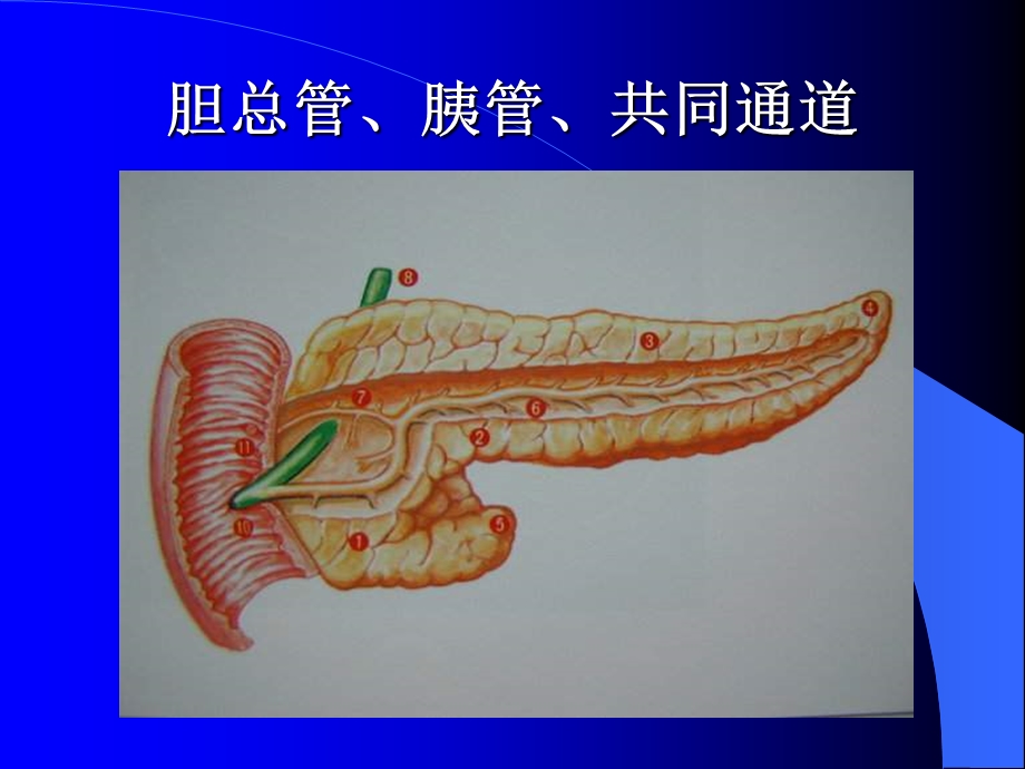 急性胰腺炎精选文档.ppt_第3页