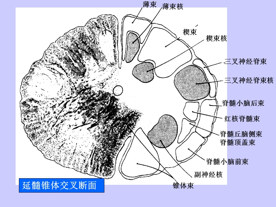 局部解剖学脑干断面图PPT文档.ppt_第2页