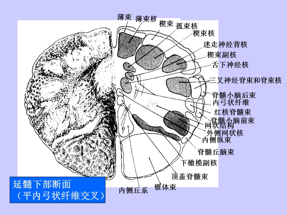 局部解剖学脑干断面图PPT文档.ppt_第3页