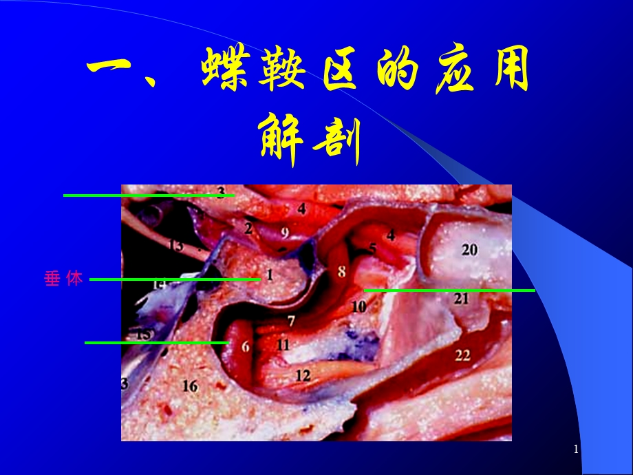 最新蝶鞍区的断层解剖课件PPT文档.ppt_第1页