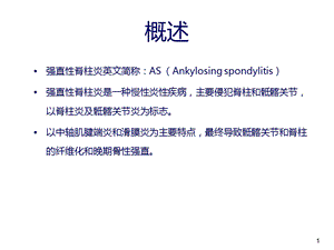 最新强直性脊柱炎ppt课件PPT文档.ppt