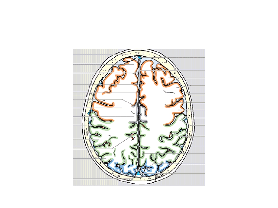 横断层脑叶划分(颜色标识)PPT文档.ppt_第2页
