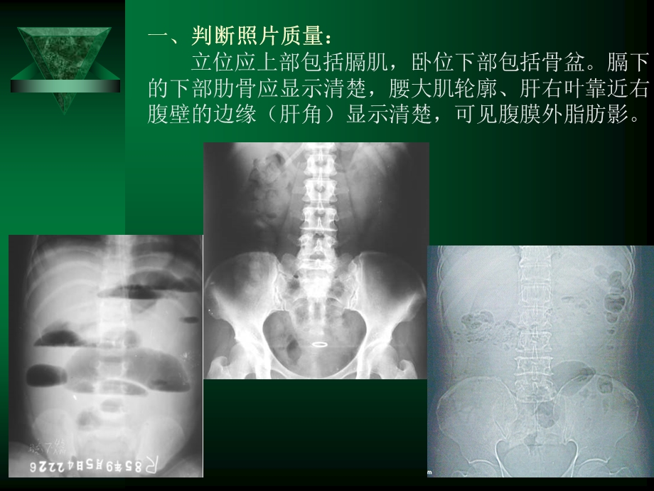 普放腹部幻灯片课件精选文档.ppt_第2页