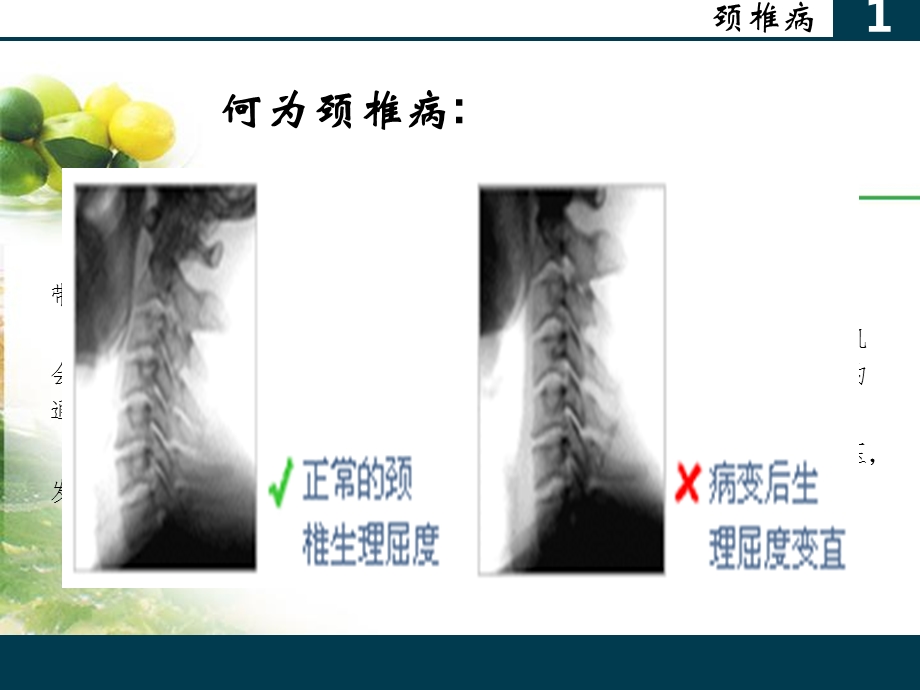 最新：办公室常见病与健康文档资料.ppt_第3页