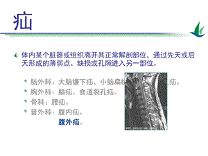 最新哈尔滨医科大肿瘤外科学腹外疝PPT文档.ppt