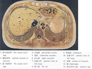 最新腹部断层彩色解剖和CTPPT文档.ppt