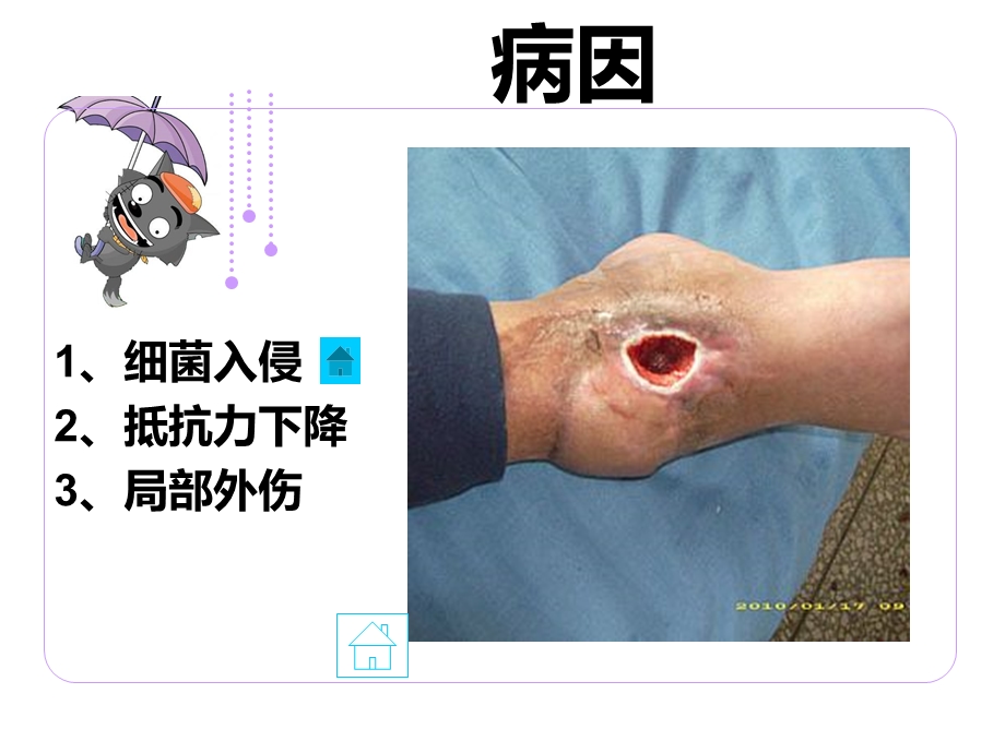 培训资料化脓性骨髓炎病人的护理文档资料.ppt_第3页