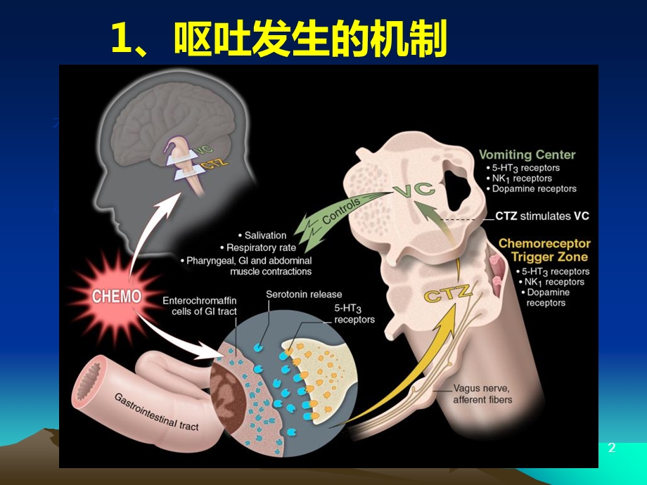 化疗所致的恶心呕吐文档资料.ppt_第2页