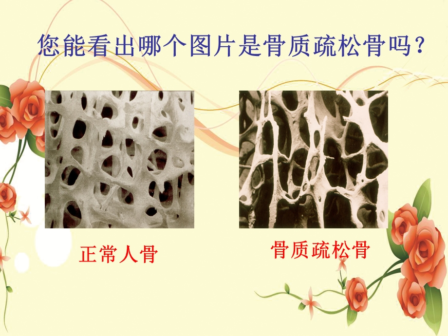 最新：专科护理学习骨质疏松ppt课件文档资料.ppt_第2页