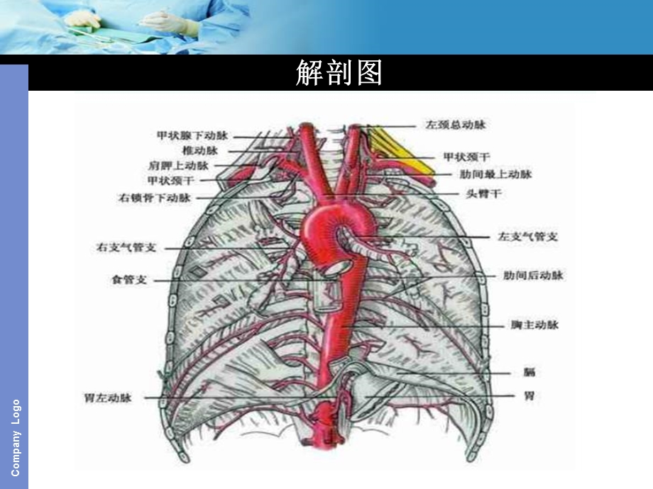 最新：主动脉夹层护理查房2文档资料.ppt_第3页