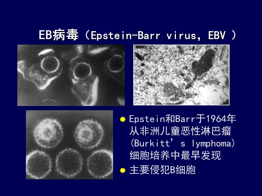 传染性单核细胞PPT文档资料.ppt_第2页