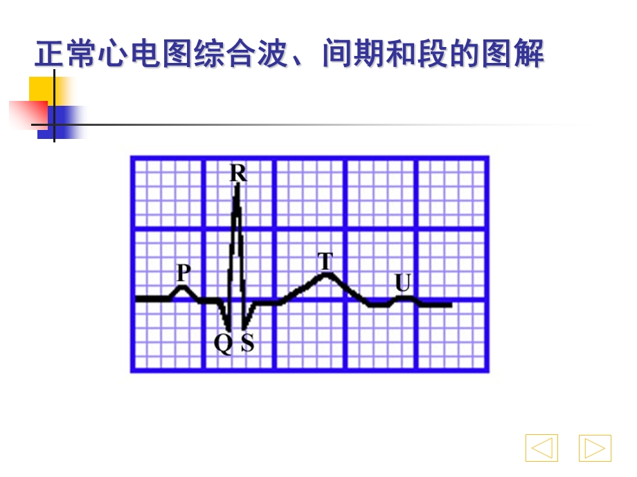 最新：心电图浅析2课件文档资料.ppt_第2页