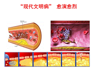 最新：关注心血管疾病危害文档资料.ppt