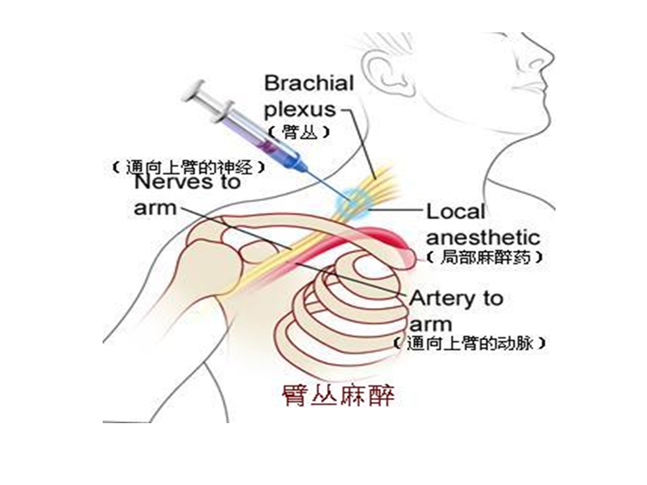 最新超声引导上肢神经阻滞PPT文档.ppt_第2页