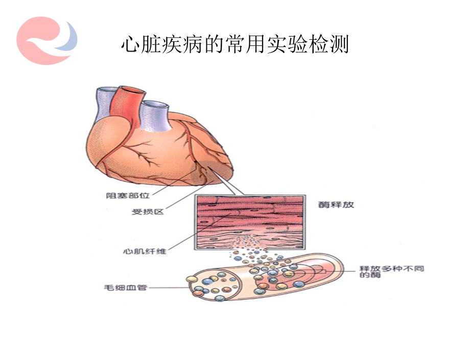 实验诊断12心肌酶及心肌损伤标志物、铁代谢精选文档.ppt_第3页