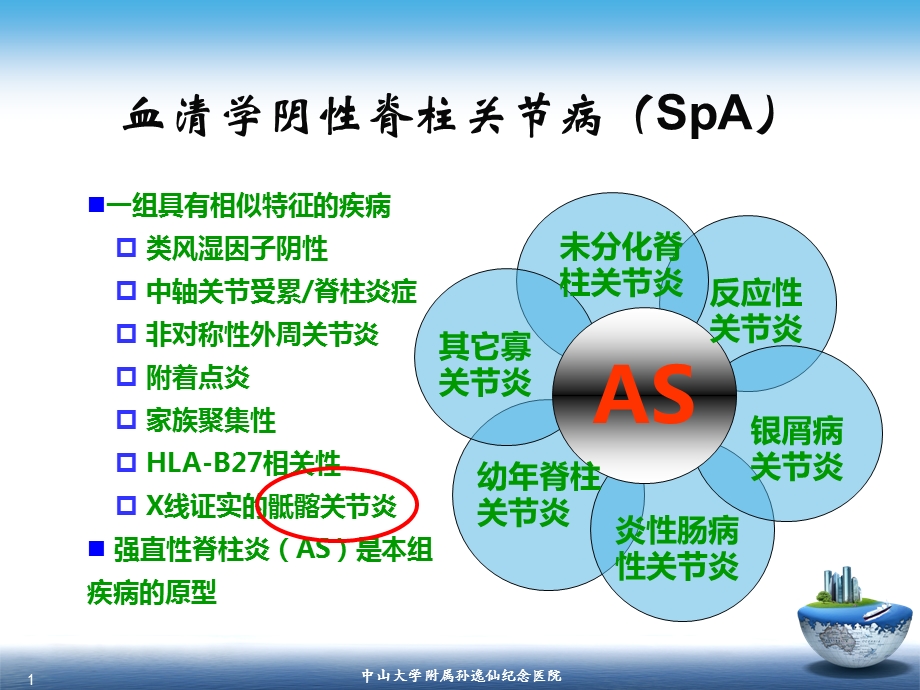 最新：SpA骶髂关节炎的影像学诊断和鉴别诊断课件文档资料.ppt_第1页