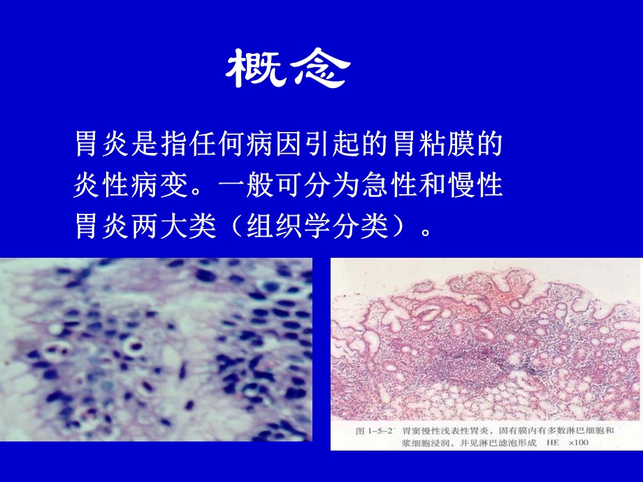 同济大学附属同济医院消化内科胃炎精选文档.ppt_第1页