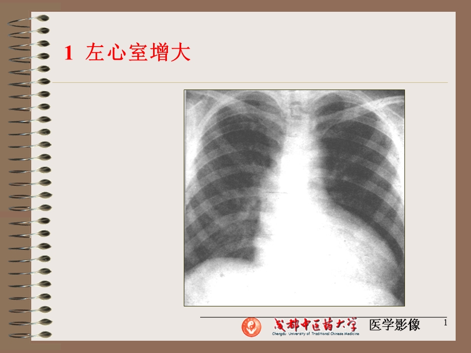 心脏基本病变X线表現文档资料.ppt_第1页