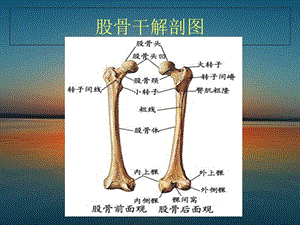 最新：股骨骨折文档资料.ppt