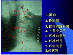 最新颈椎X片课件PPT文档.ppt