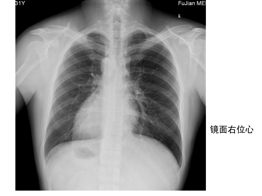 心脏大血管先天异常ppt课件文档资料.ppt_第2页