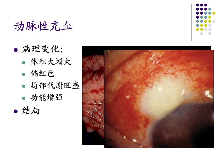 4血液循环newPPT课件.ppt_第3页