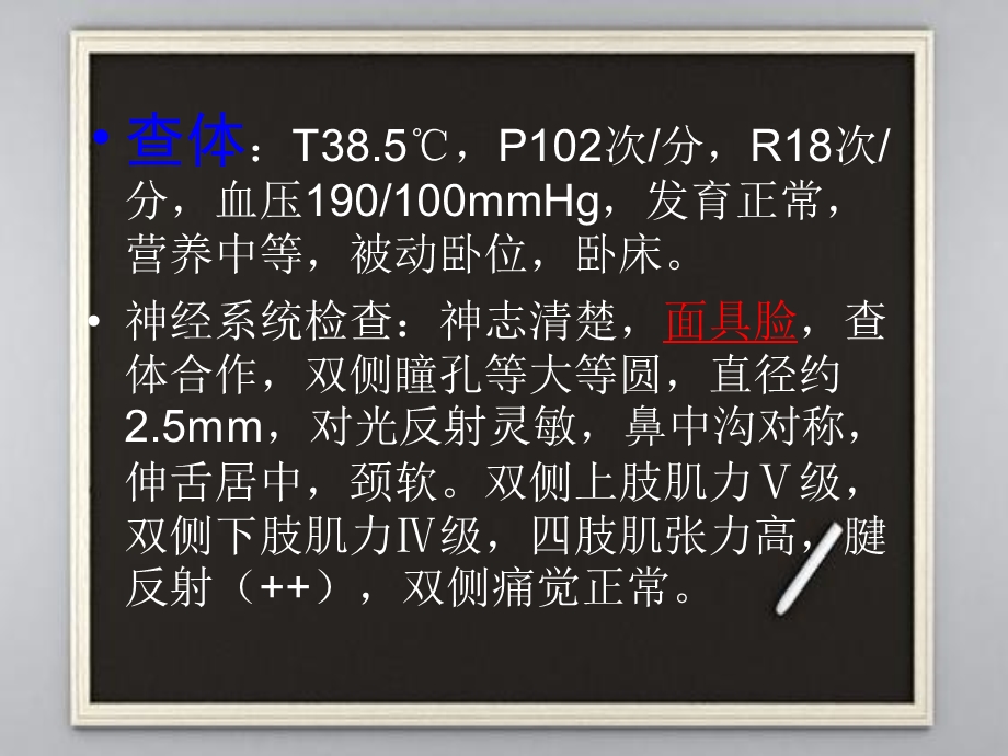 帕金森病护理查房PPT文档资料.ppt_第2页